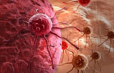 раковые клетки