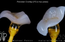 tehcnosotnya.com_2457