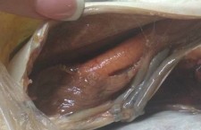 глисты в рыбе