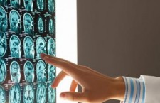 мозг, память