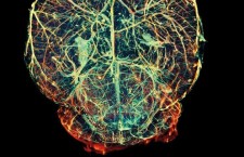 альцгеймер